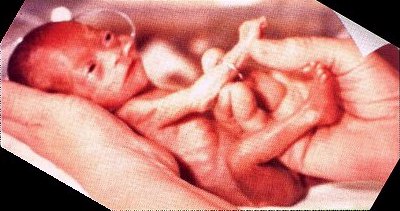 This is how a 21 weeks old embryo looks like... This is how a 21 weeks old embryo looks like...